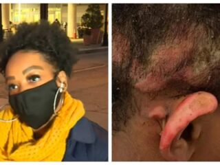Teenage girl charged after setting classmate hair on fire