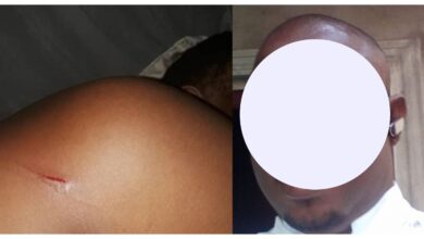 Nigerian man wakes up to bruises on his body after being attacked in his dream