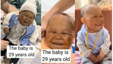 Meet 29-year-old ‘baby’ who can’t grow due to rare medical condition