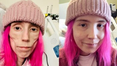 26-year-old disabled lady shares progress after one month at hospital