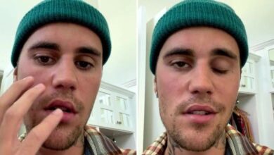 Justin Bieber seriously sick, suffers facial paralysis