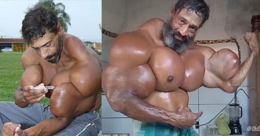 TikTok star dies after injecting himself with life-threatening oil to achieve 23-inch biceps
