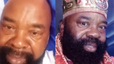 Actor, Emeka Ani seeks help as he reveals he’s battling eye problem that could lead to blindness [Video]