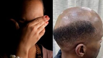 He embarrasses me at work – 28-year-old lady cries out over her 31-yr-old husband’s developing baldness