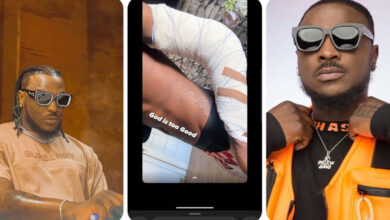 Singer Peruzzi Shares Photo Of His Bruised Body And Bandaged Arm After Escaping An Accident (DETAIL)