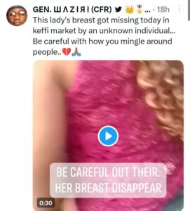 Lady's breast goes missing 