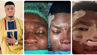 “Thanks for Giving Me My Dream Nose” – Skitmaker Zics Aloma Undergoes Facial Surgery in Turkey