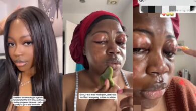 Lady shares how her eyelids began to swell after using eyelash extensions