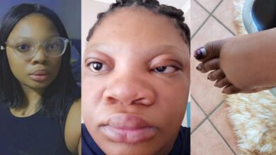 "Is she allergic to pregnancy?" – Lady's pregnancy transformation stirs unease